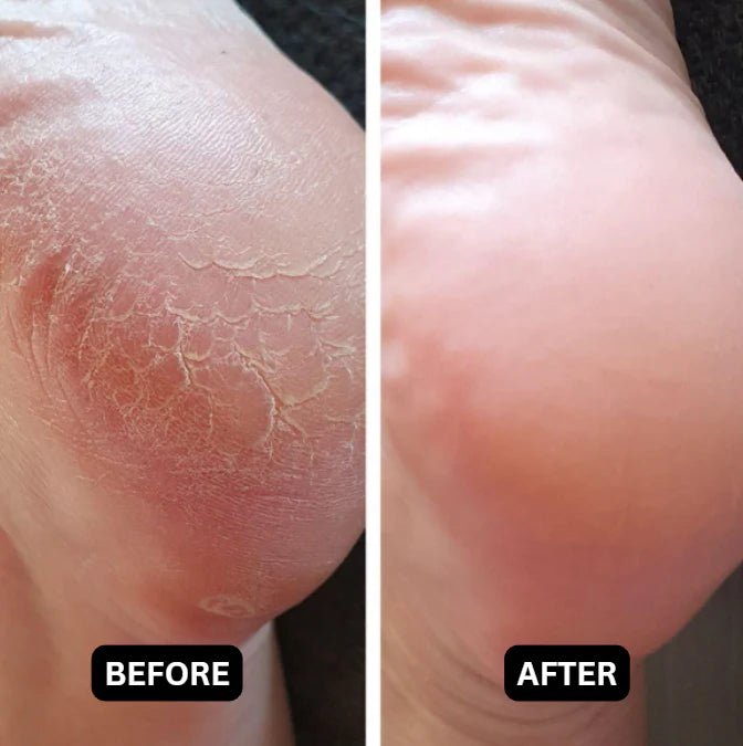 Revive  Nourish Foot Cream™